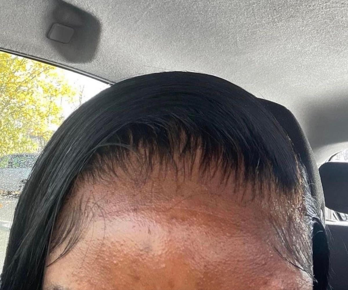 Indian - Raw Straight Closure